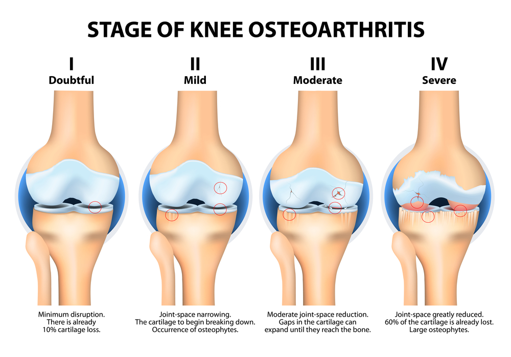 Egoscue of Orange County - E-Cise of the Week: Modified IT Band