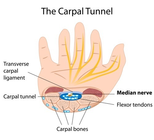 The carpal tunnel as it relates to ESWT